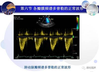 正常心脏超声诊断中频谱监测技术的研究与应用进展